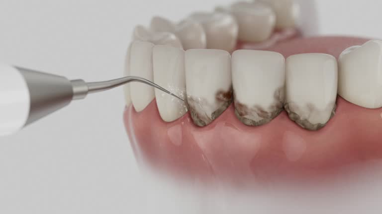 Trusted Root Canal Treatment service in Robbins, IL - Dentist Open Now